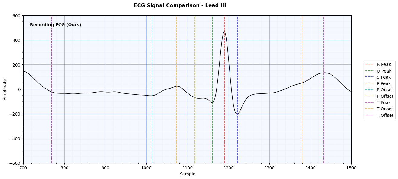 Photo of a lead III ECG signal measured using our method